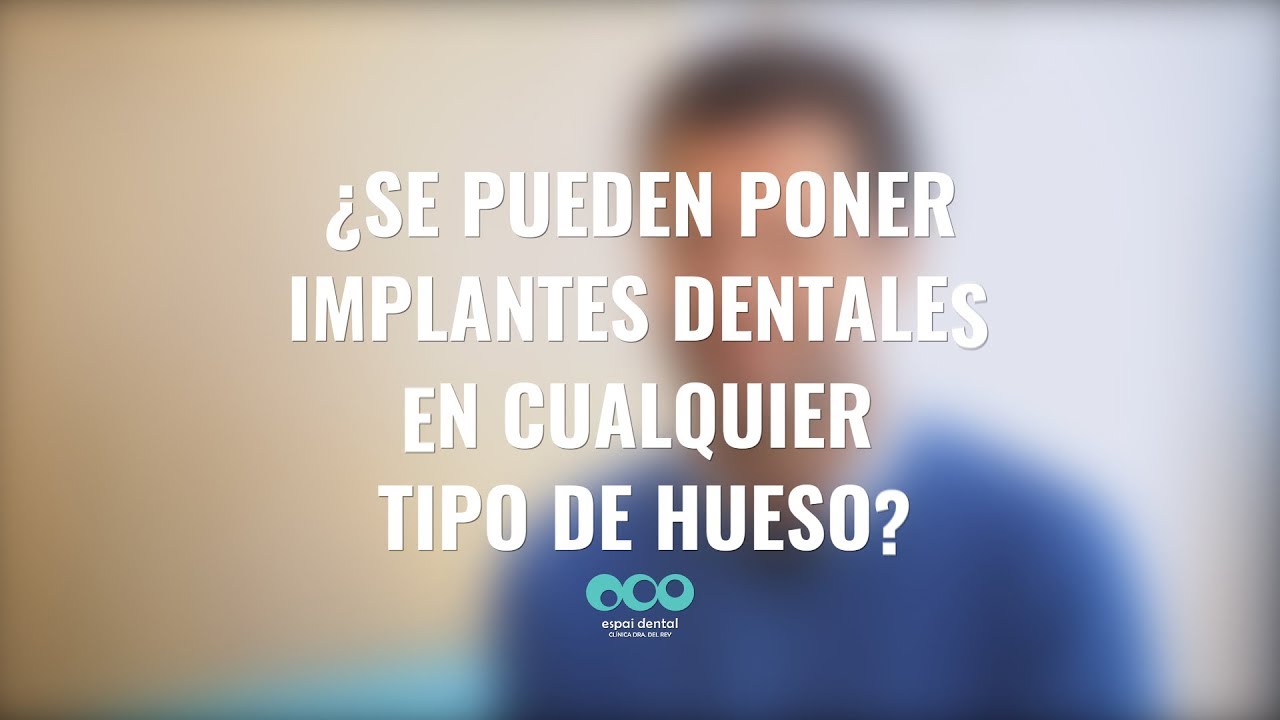 ¿Se pueden poner implantes dentales en cualquier tipo de hueso?