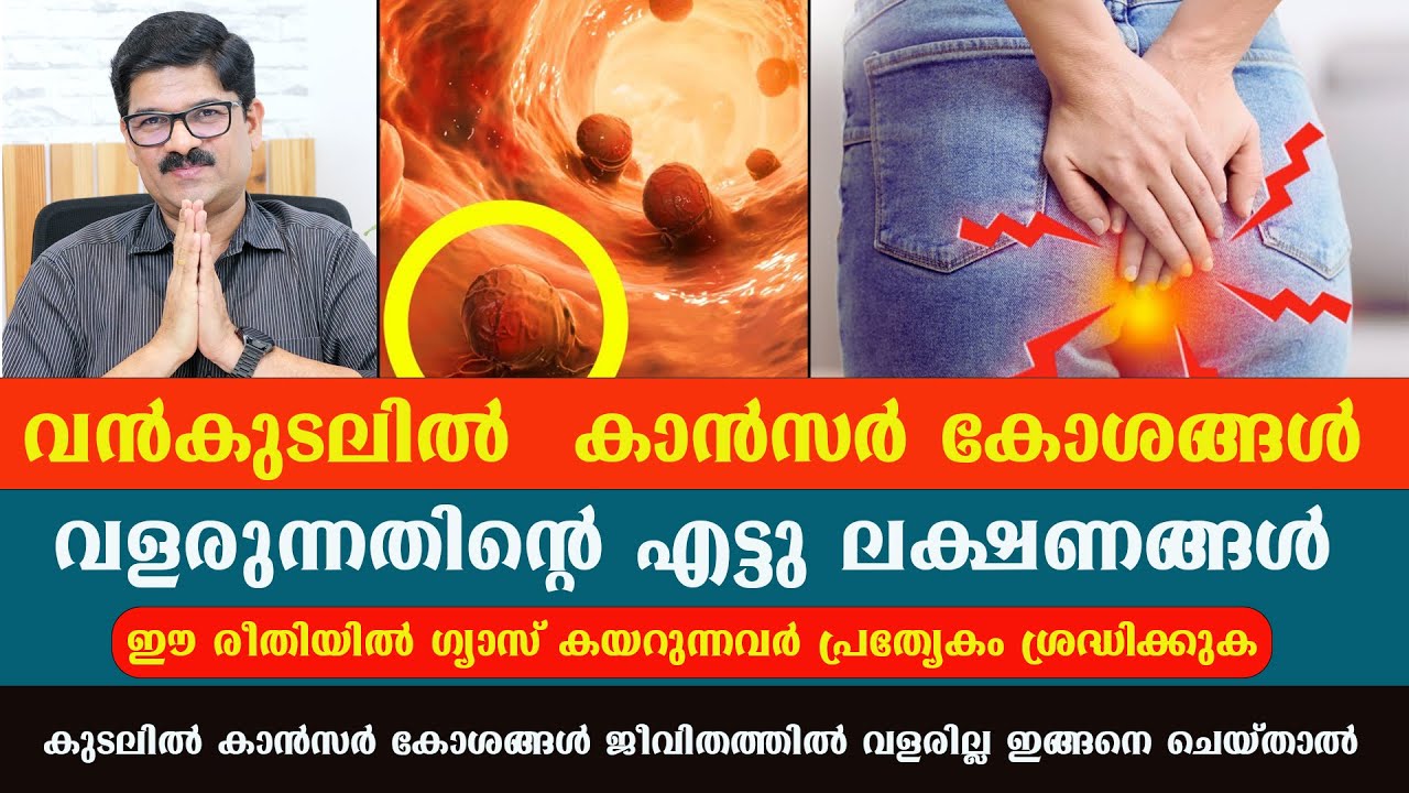 വൻകുടലിൽ  കാൻസർ  വളരുന്നതിന്റെ എട്ടു ലക്ഷണങ്ങൾ .ഈ രീതിയിൽ ഗ്യാസ് കയറുന്നവർ  ശ്രദ്ധിക്കുക / Dr Shimji