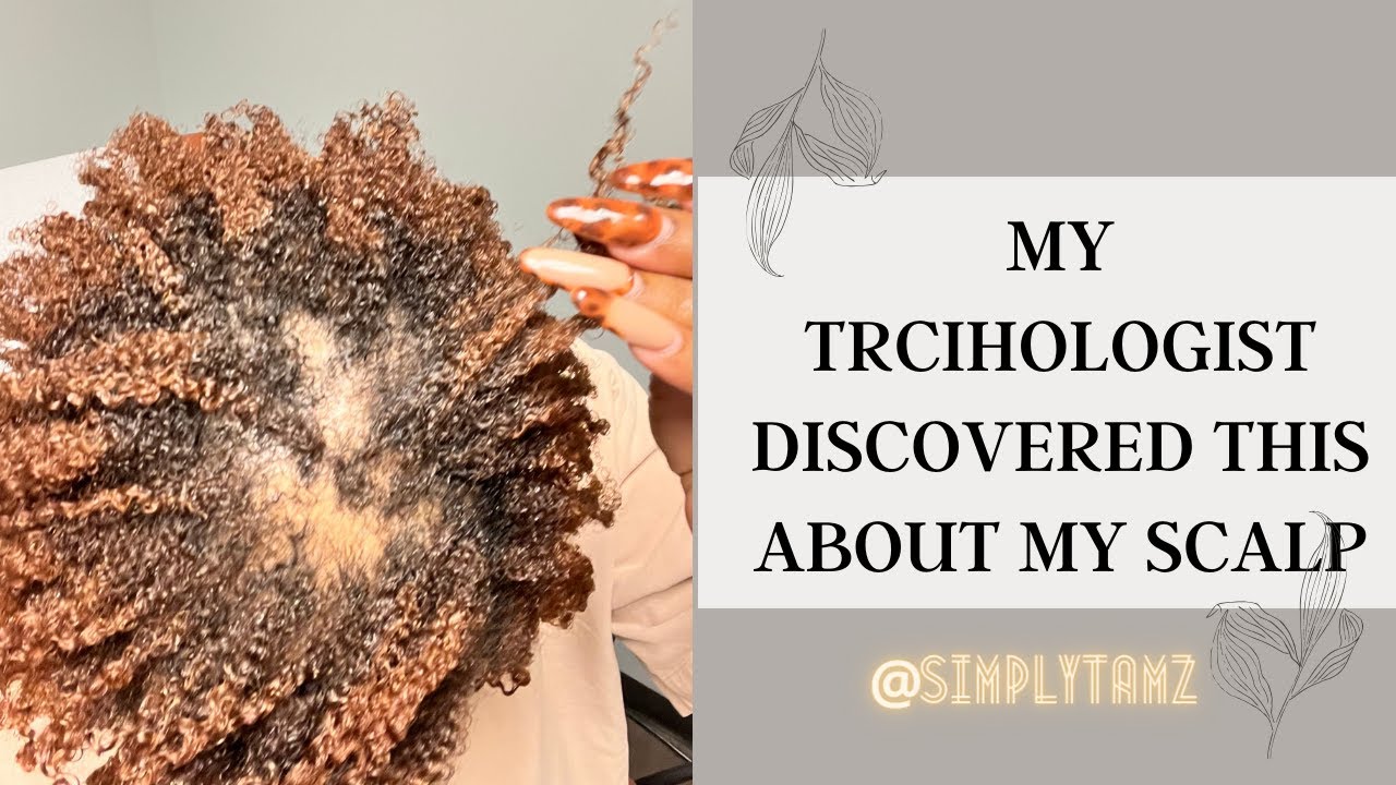 Trichologist Visit for HAIR LOSS|Hair Update #hairloss