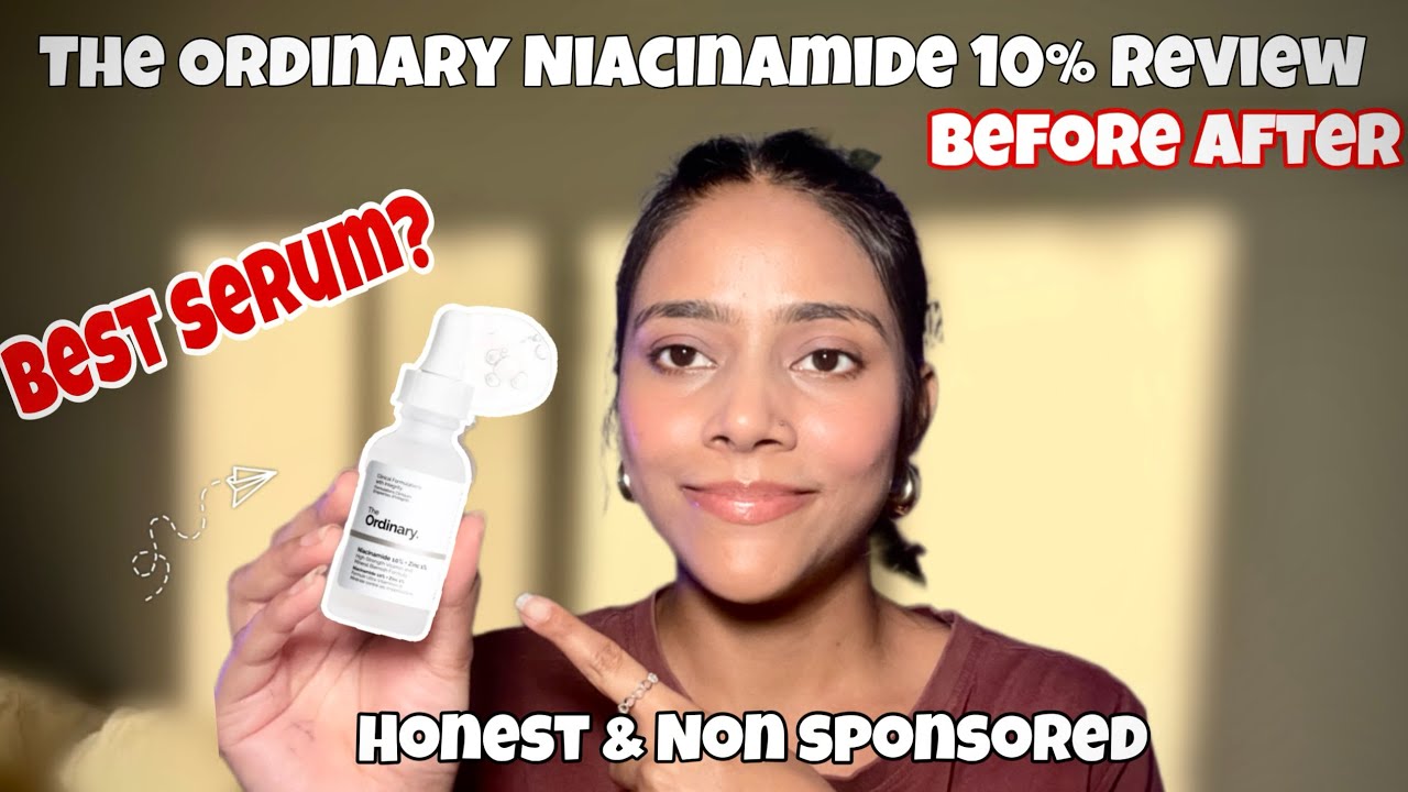 The Ordinary Niacinamide Review + Before After | Best Serum for Acne & Glow?
