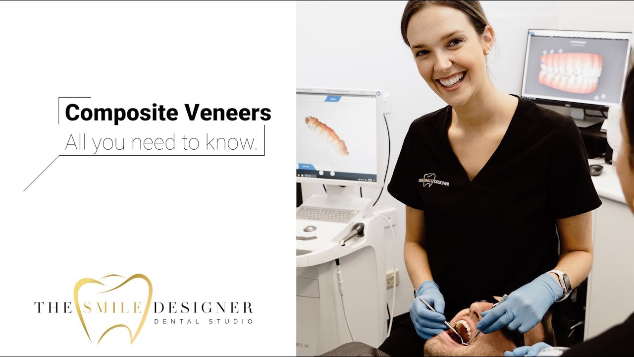 Composite Veneers | Everything you need to know