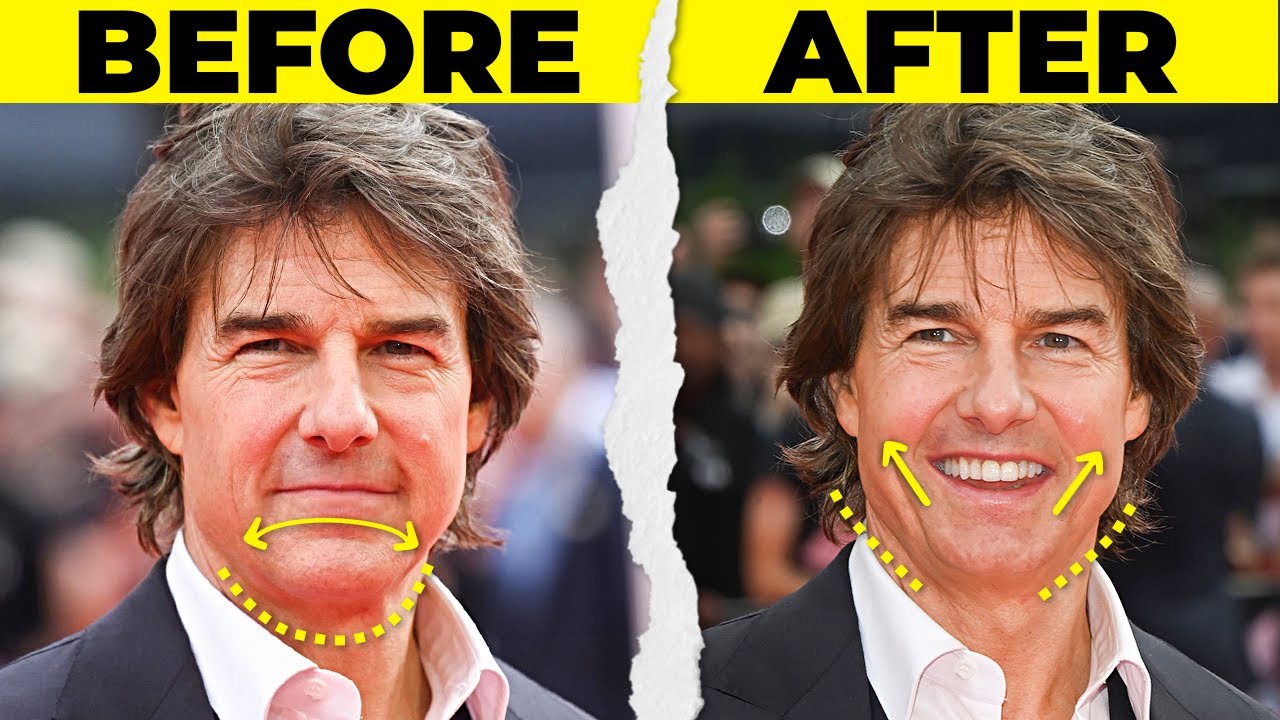 Dentist Reveals The Secret Behind Those Perfect Looking Smiles