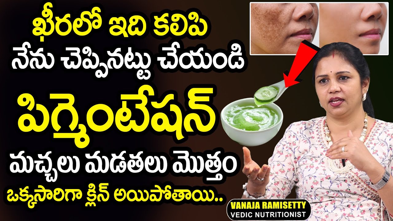 ఖీరలో ఇది కలిపి పుస్తె పిగ్మెంటేషన్ మచ్చలు మడతలు మొత్తం | Vanaja Ramisetty About Summer Pigmentation