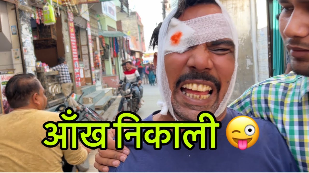 शर्त मे आँख निकाली 😜😜😜😜😜😜🎥😅😅#indian #comedy #funny #shadabjakati #saudiarabia