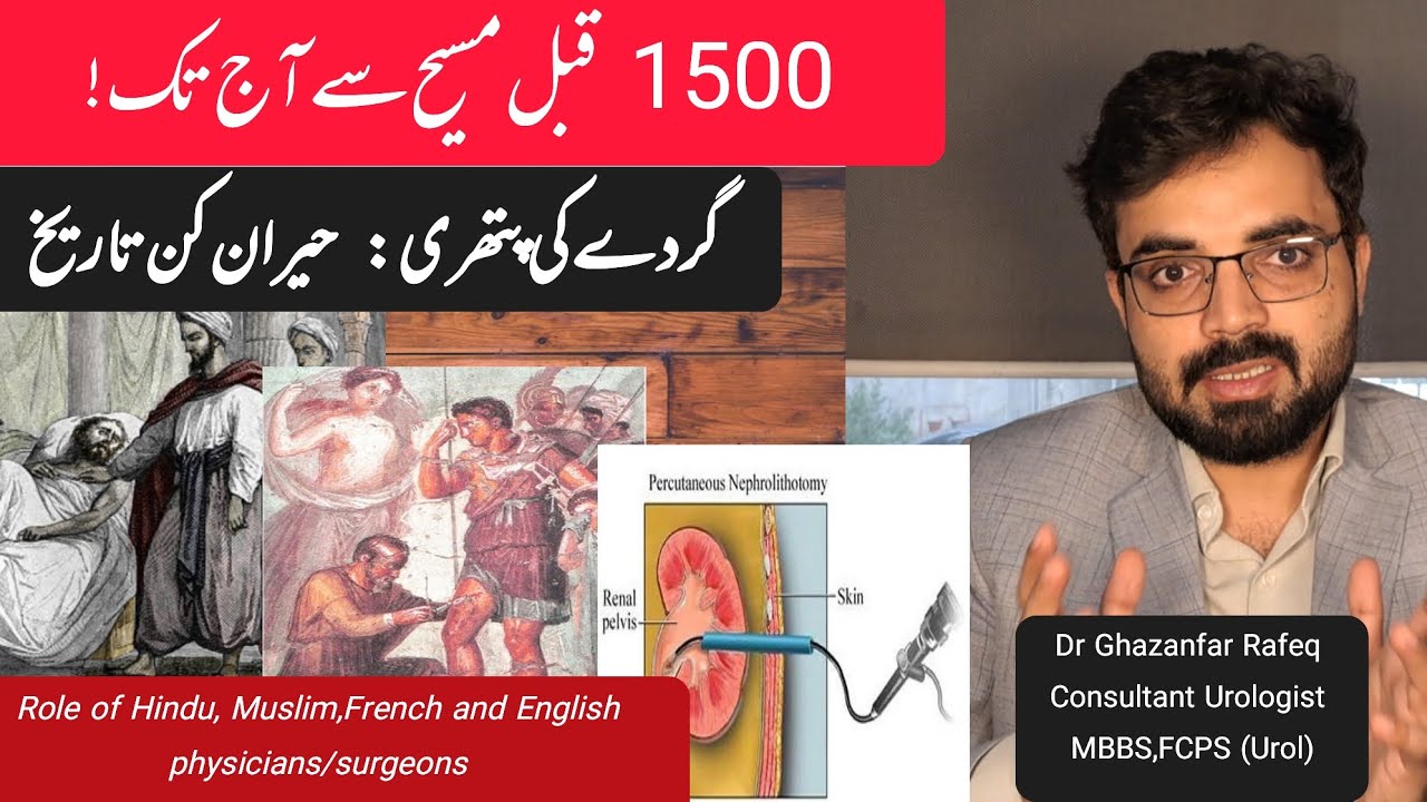 Kidney & Bladder Stones: From 1500 BC Remedies to Modern Laser Treatment|Urologist|Dr Ghazanfar