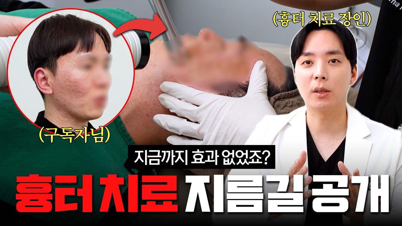 지긋지긋한 흉터.. 무조건 없앨 수 있는 방법 알려드릴게요. 울트라클리어 + 쥬브아셀