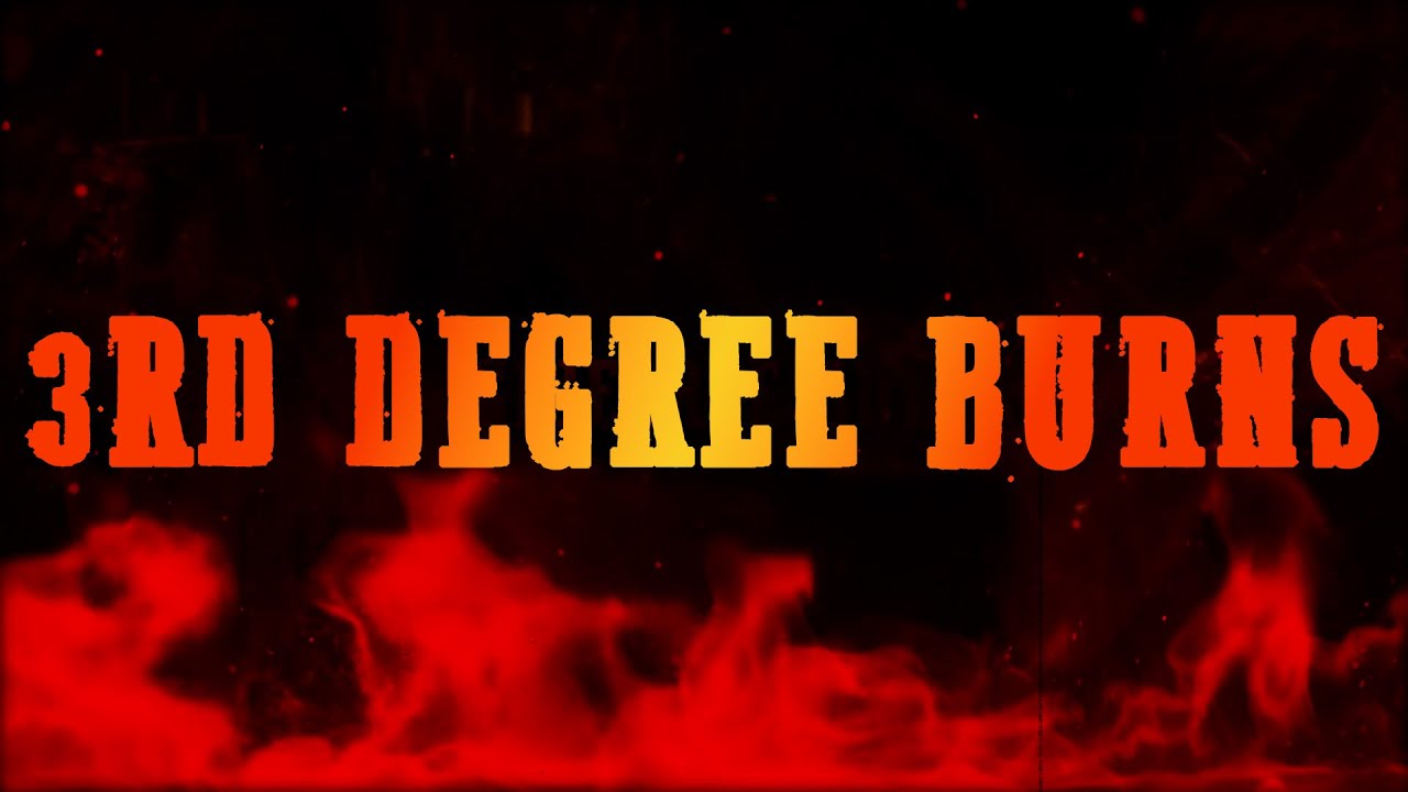 Citizen Soldier x Blank Era - 3rd Degree Burns (Official Lyric Video)