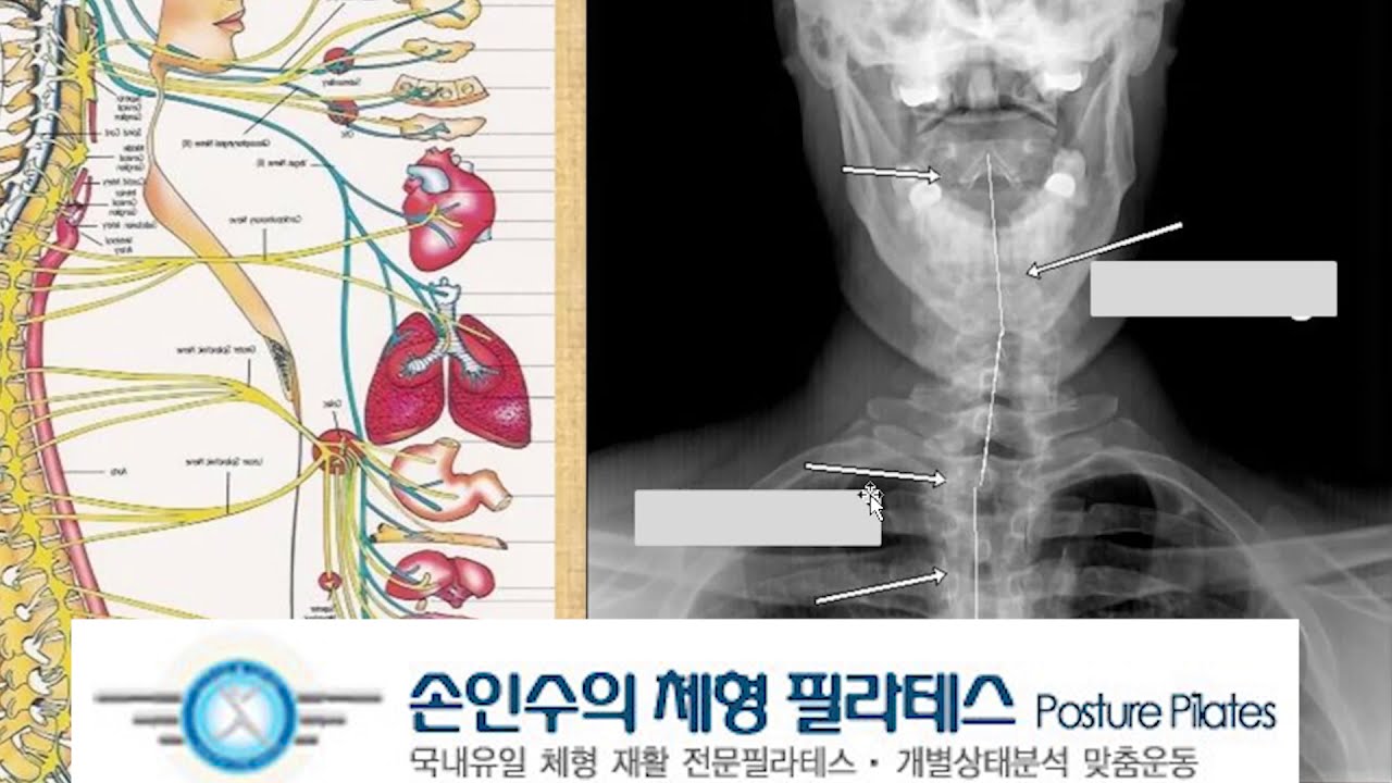 마사지해도 다시 뭉치는 이유? 근육이 아닌 '뇌'를 바꿔야 합니다 (체형 정렬의 과학)