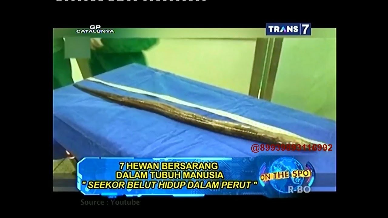 On The Spot - 7 Hewan Bersarang Dalam Tubuh Manusia