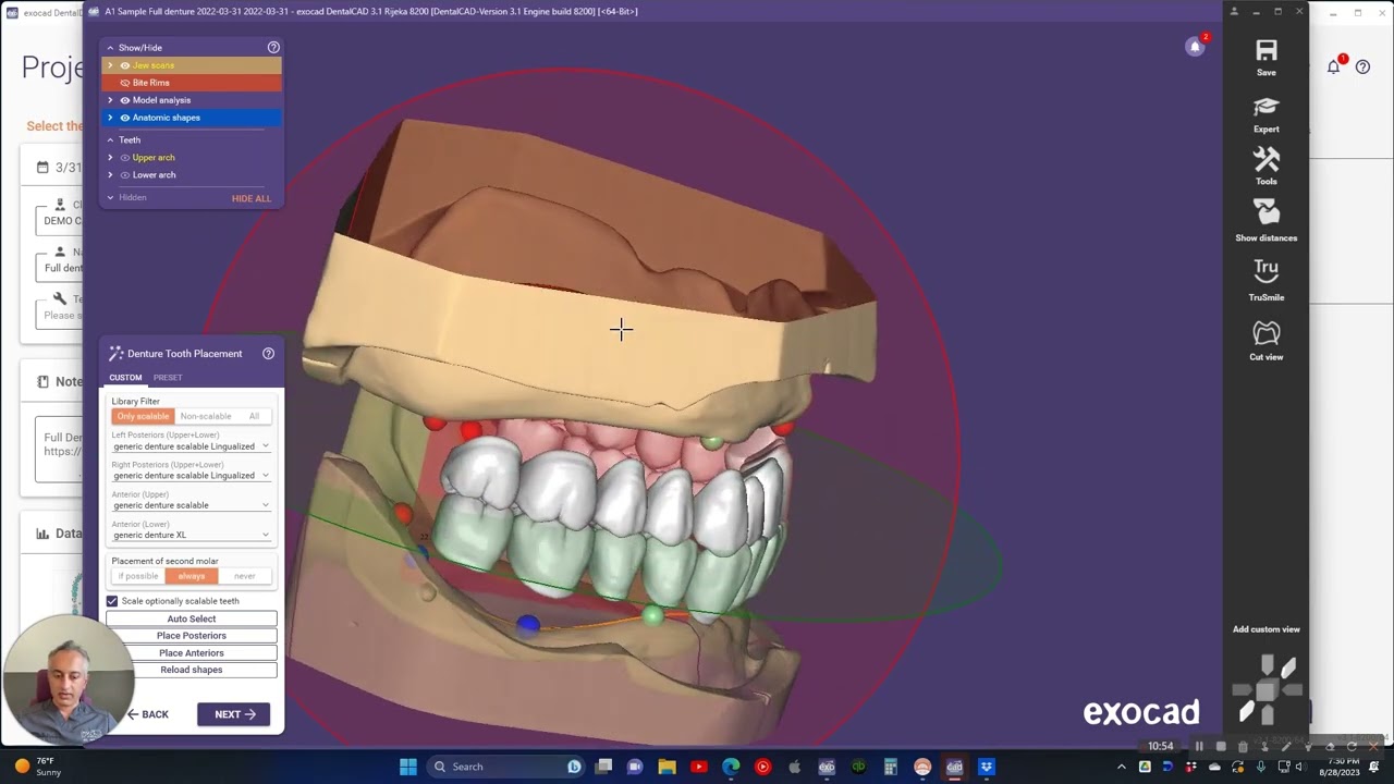 How to: Basic Full Denture Design in Exocad