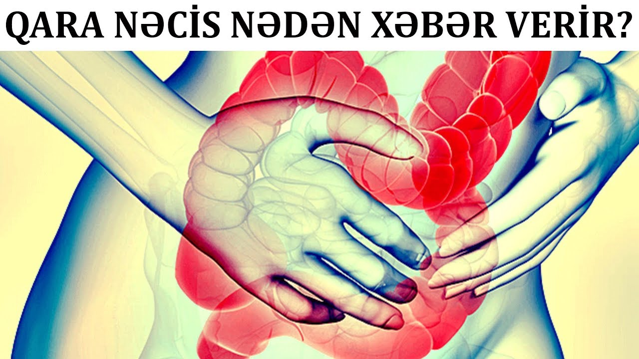 QARA NƏCİS nəyin əlamətidir? - Mədəniz sizi köməyə çağırır