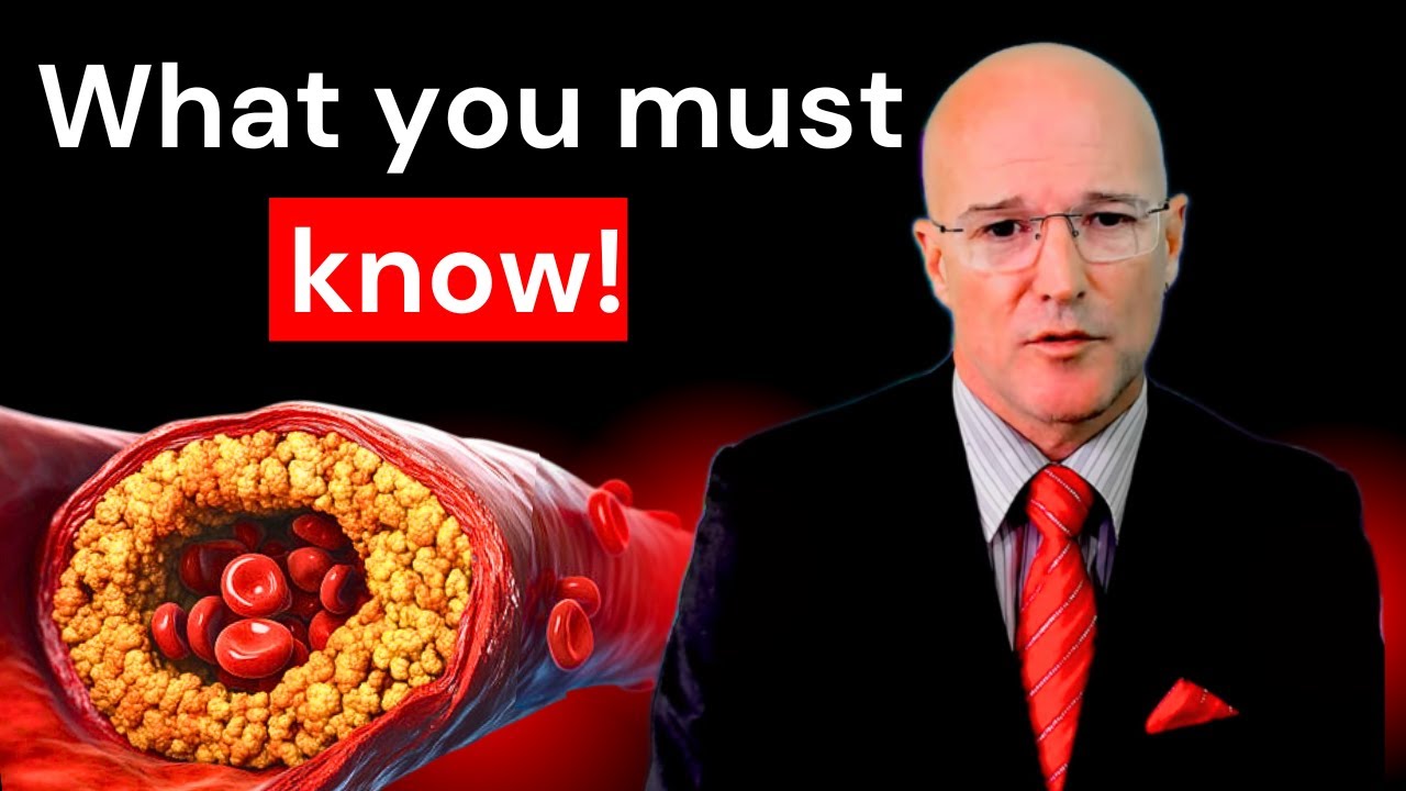 Atherosclerosis Lecture | Prof. Bart Kay Breaks Down the Basics. part 1