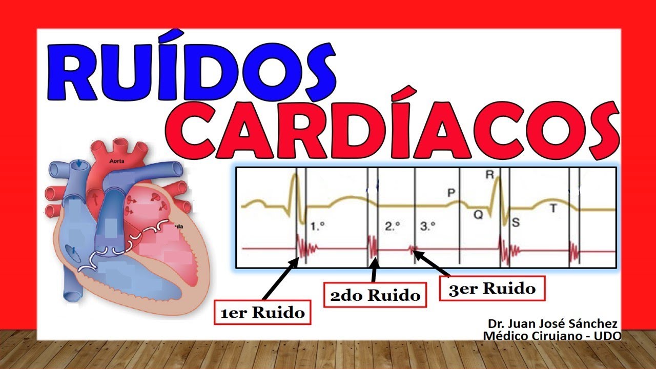 🥇 RUIDOS CARDÍACOS. (R1, R2, R3 y R4) ¡Fácil Explicación!