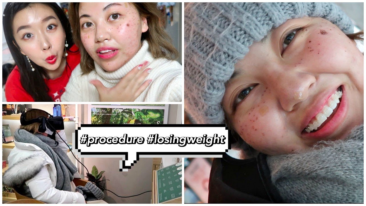 i got something done to my face...