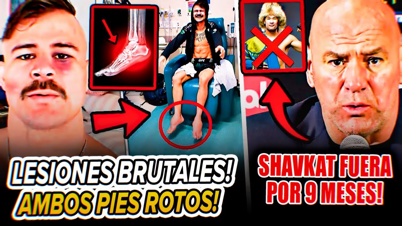 ¡Diego Lopes REVELA LESIONES BRUTALES tras el UFC 325! Shavkat Rakhmonov FUERA por 9 MESES!