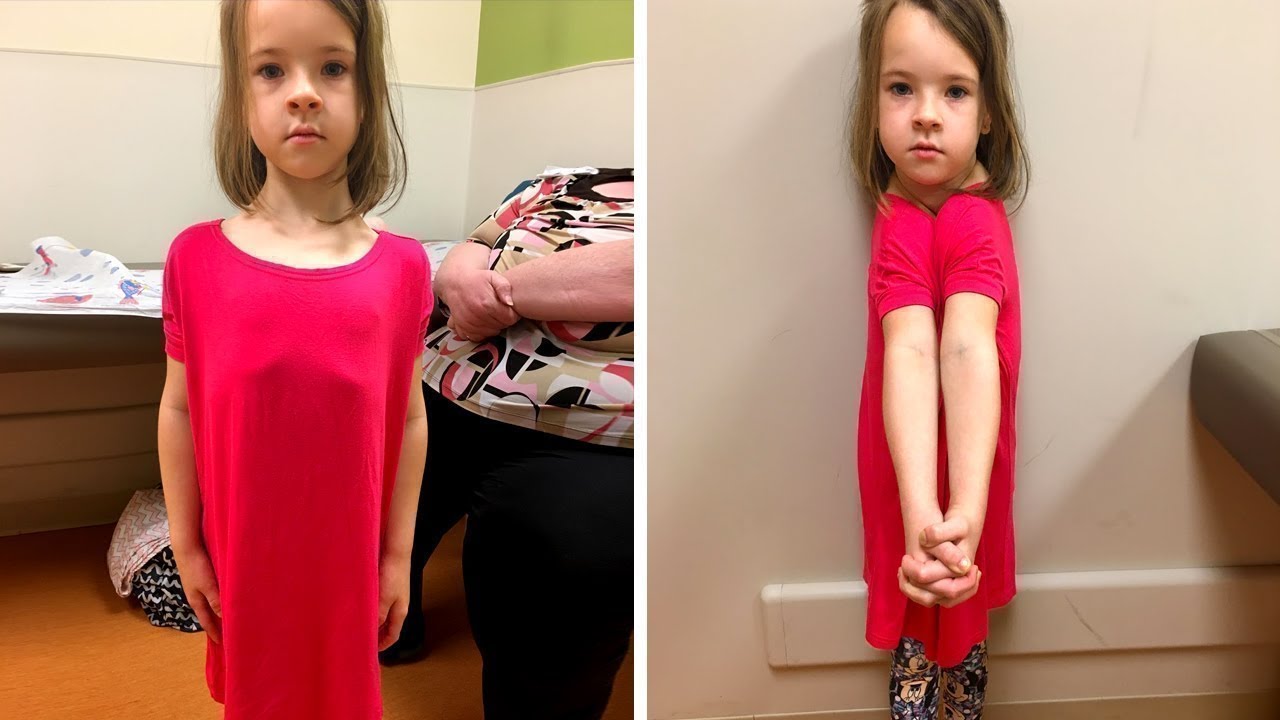 She Was Born WITHOUT a Collarbone!