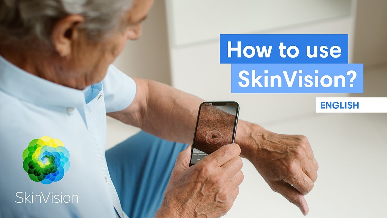 How to Use the SkinVision App | SkinVision