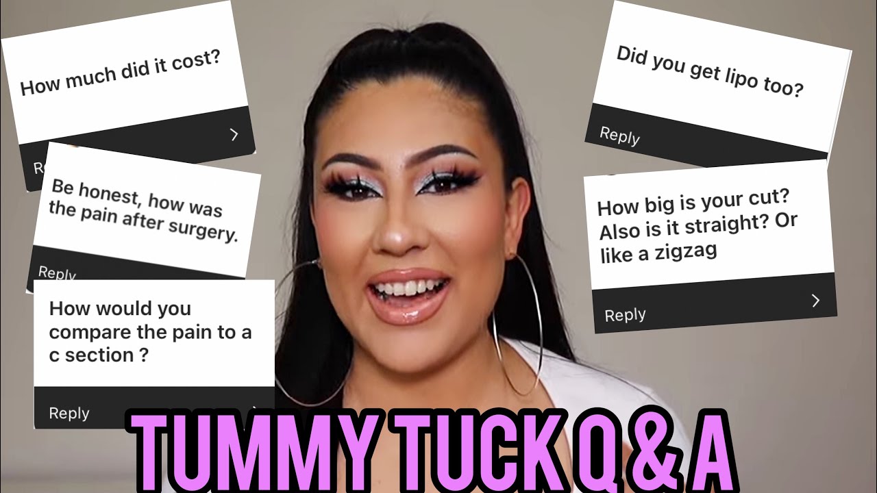 TUMMY TUCK Q & A *4 WEEK UPDATE* | TUMMY TUCK WITH DOC TANEJA EP. 6 | Alma Rivera Beauty