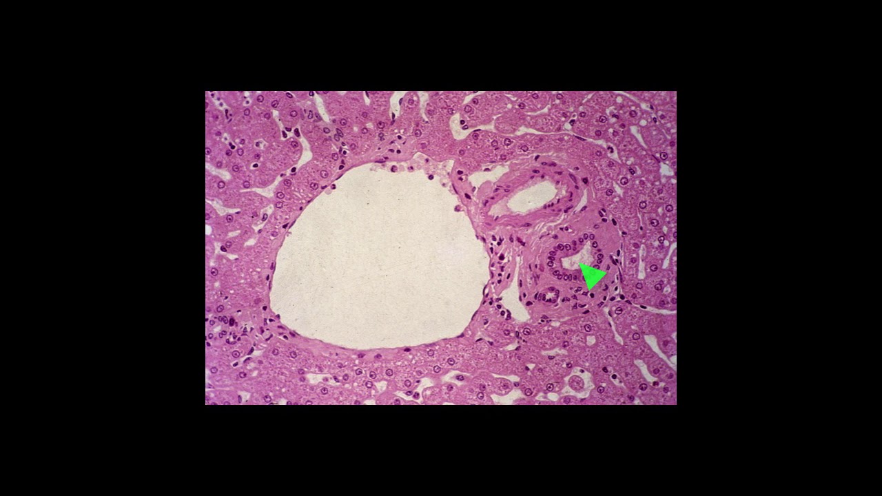 Liver Gallbladder Pancreas Lab