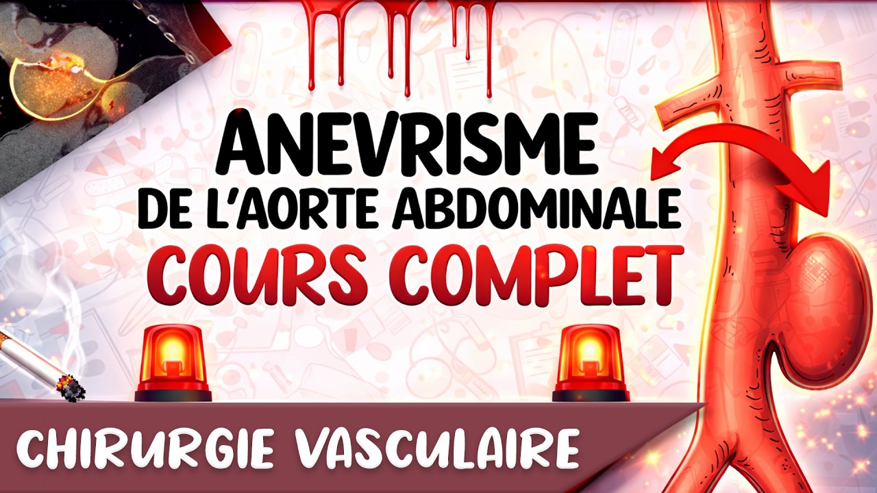 Tout Savoir sur L'Anévrisme de l’Aorte Abdominale: Physiopathologie, Causes, Diagnostic, Traitement