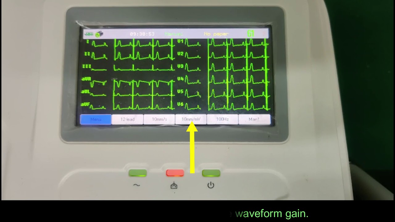 Electrocardiógrafo Portátil Digital E30 - Biolight