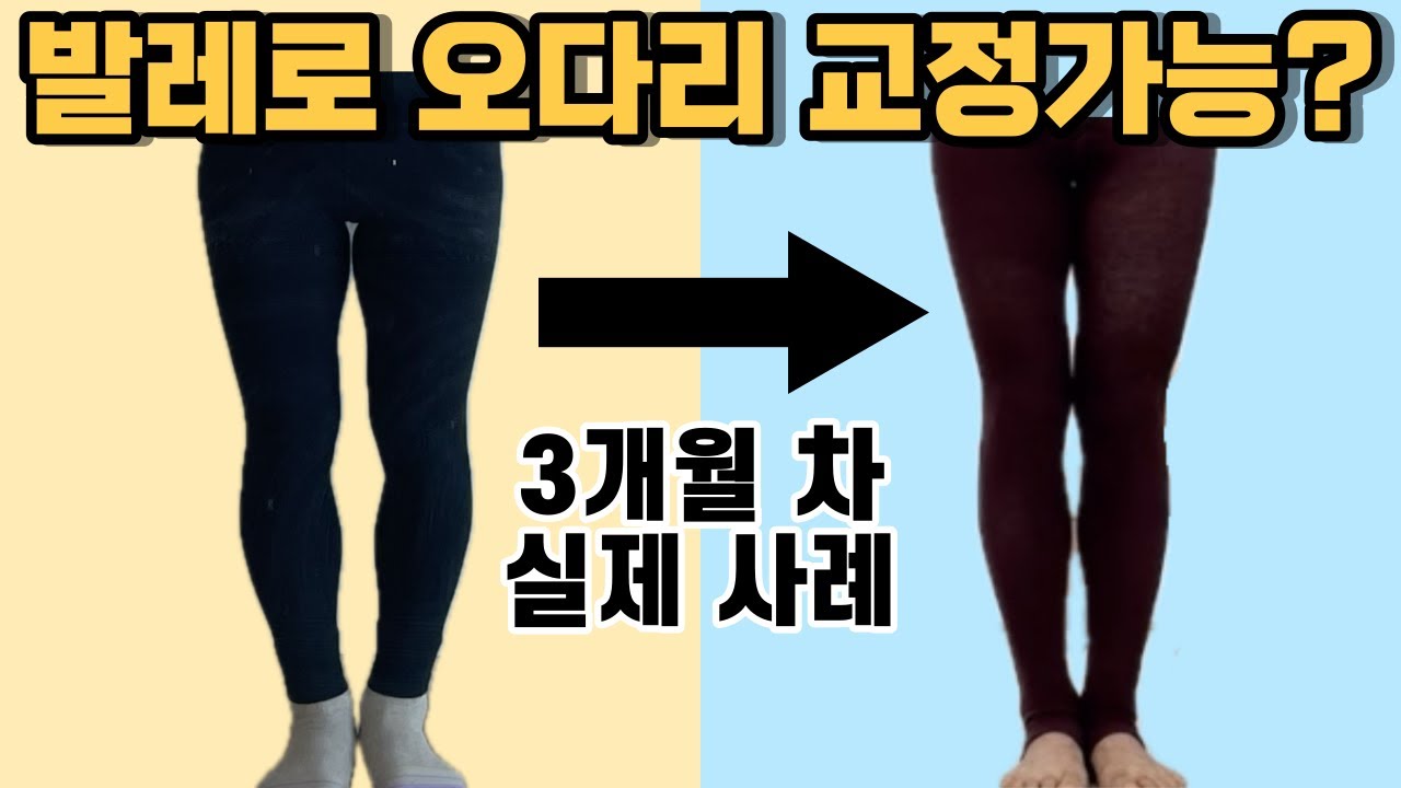 초중급ㅣ발레로 예쁜다리🩵만들자 1편ㅣO다리교정 외회전형 내회전형 오다리 운동ㅣ다리모양 오자다리 휜다리 교정발레 일자다리