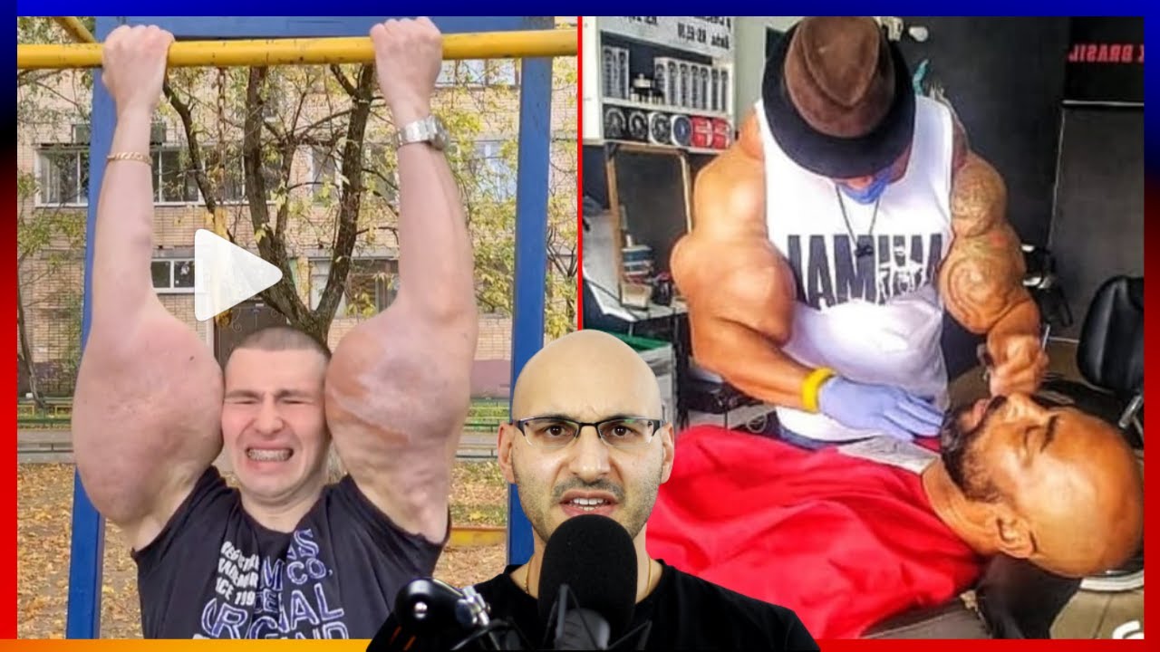 Never Skip Synthol Day
