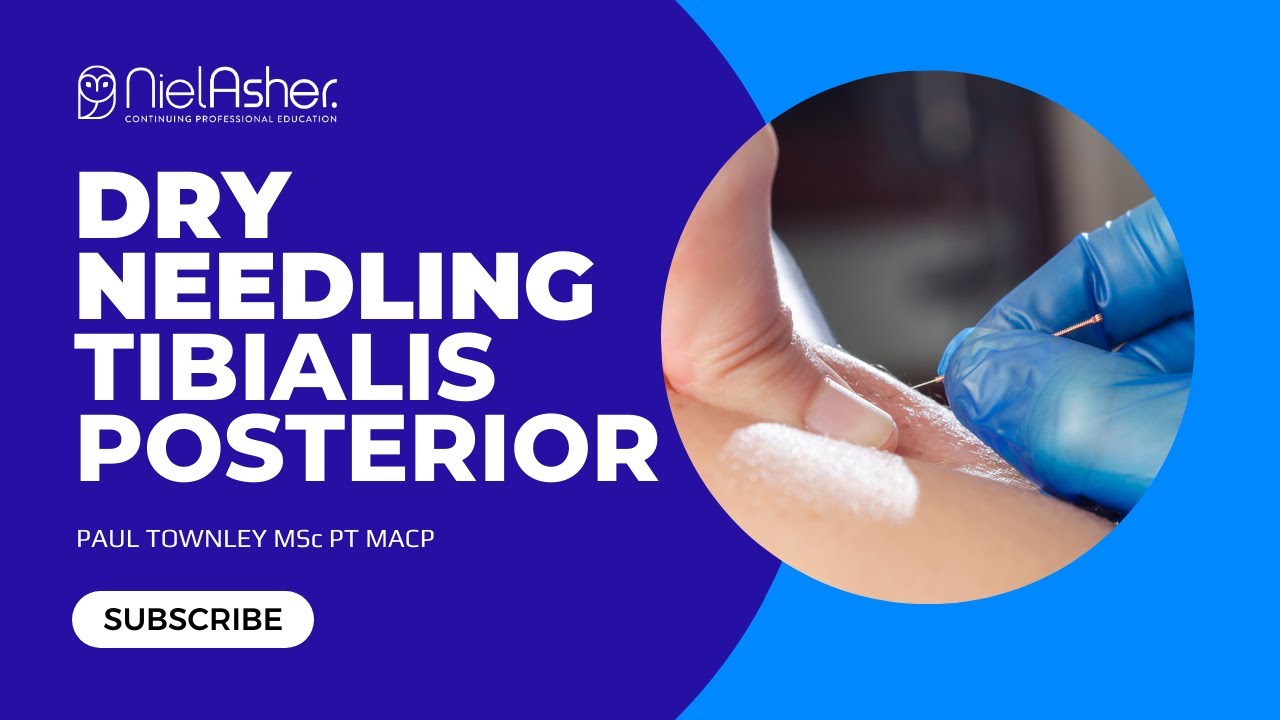 Dry Needling - Tibialis Posterior