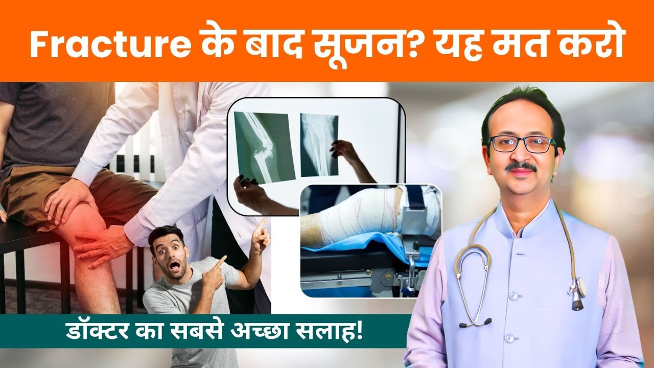 Fracture के बाद सूजन? यह गलती मत करना! सबसे अच्छा सूजन उपचार समझाया गया #drrameshwarkumar