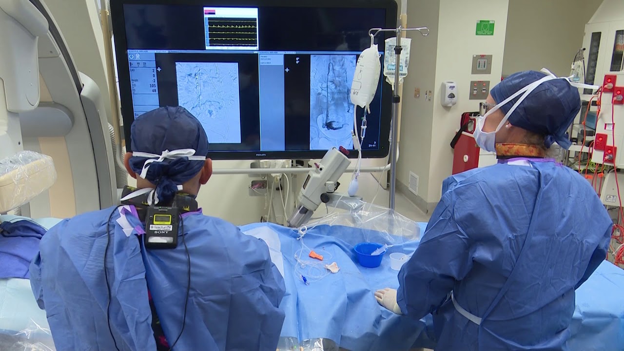 Pelvic Congestion Syndrome - Procedure