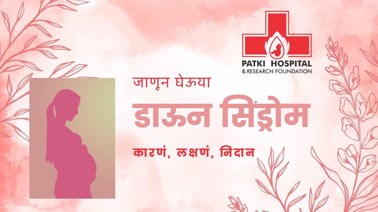 डाऊन सिंड्रोम कारणं, लक्षणं, निदान. (Down syndrome causes, Diagnostic method,  symptoms)