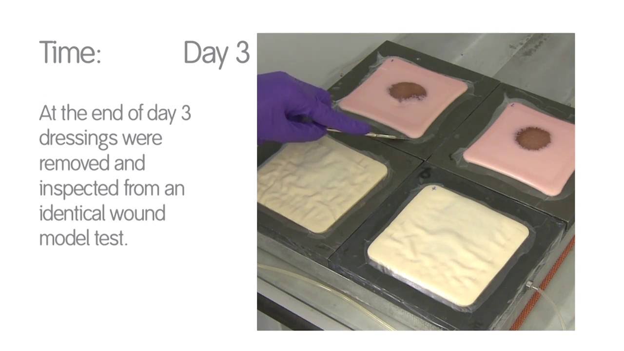 Foam Dressing Comparison - ALLEVYN Non-Adhesive vs Tielle Xtra