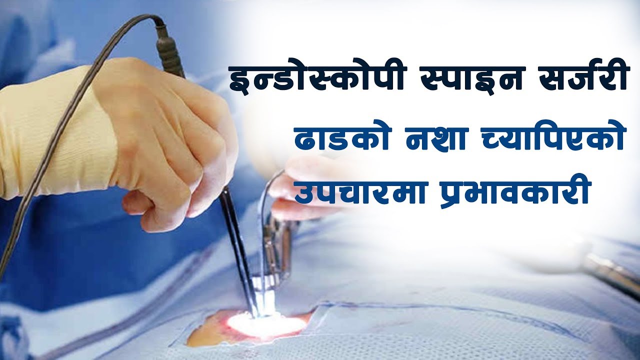 ढाडको नशा च्यापिएको उपचारमा प्रभावकारी इन्डोस्कोपी स्पाइन सर्जरी - Dr. Abhay Yadav | Hamro Doctor