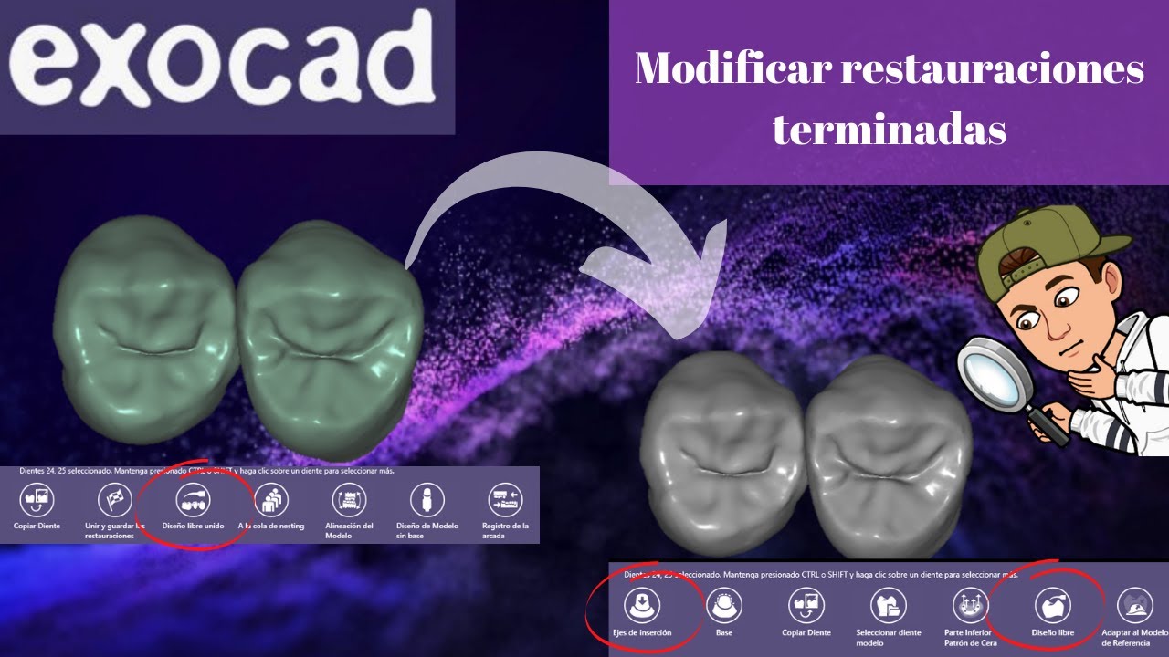 Como modificar restauraciones terminadas en exocad🚀🌀