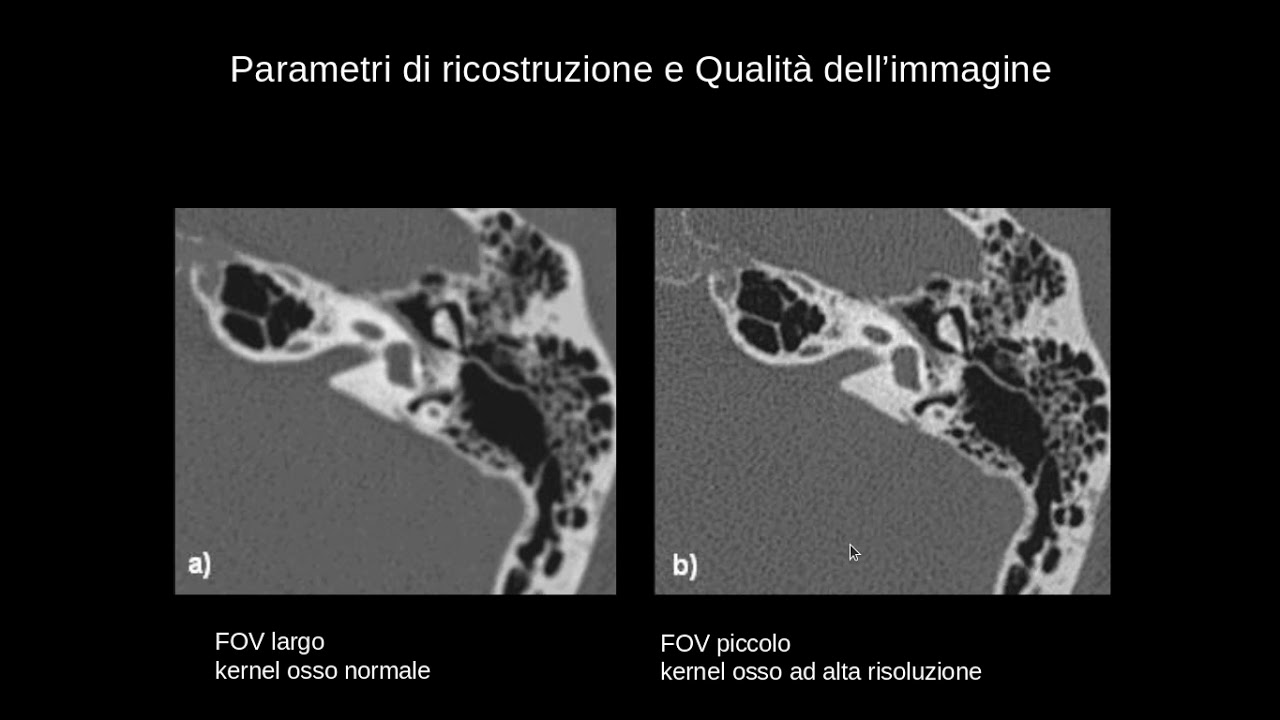 Tecnica Studio Imaging Orecchio