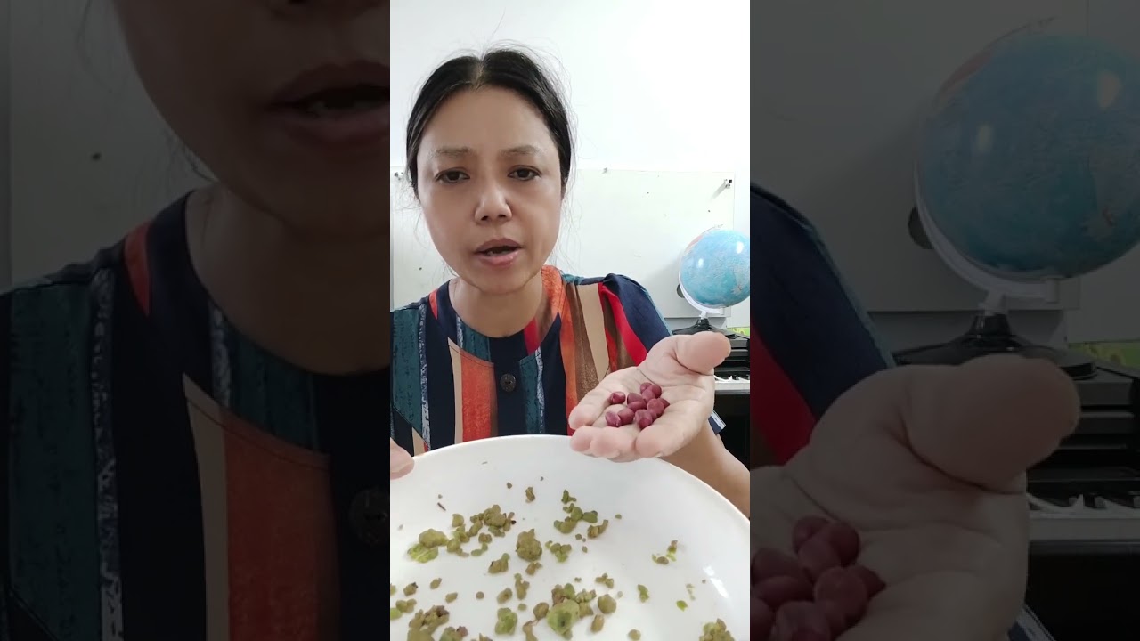 Tẩy sỏi gan mật phần 3.Sỏi ra nhiều quá.