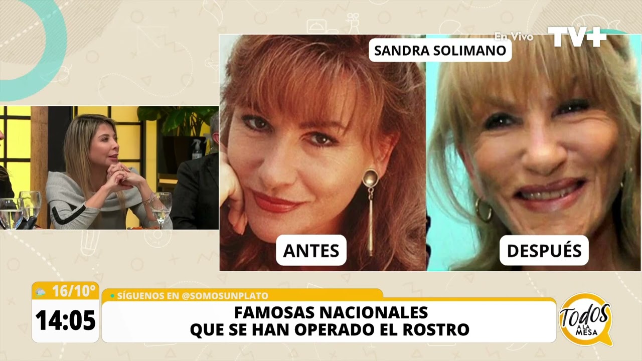 Las cirugías estéticas de las famosas chilenas