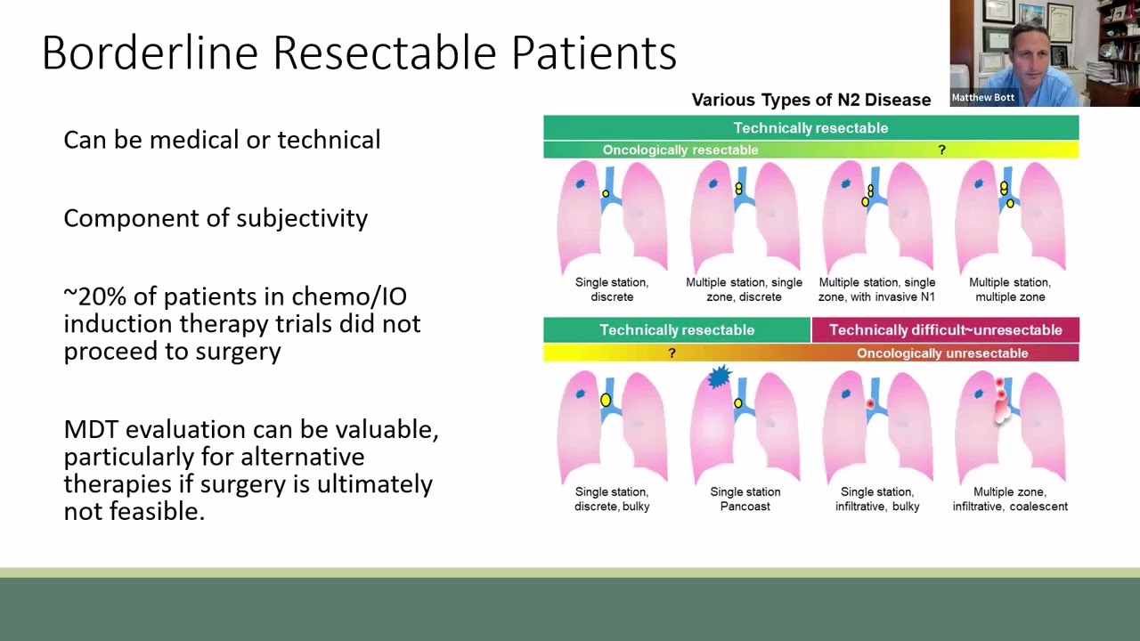 Серия «8 из 8»: Роль хирурга в междисциплинарном стадировании рака легких и командном планировании