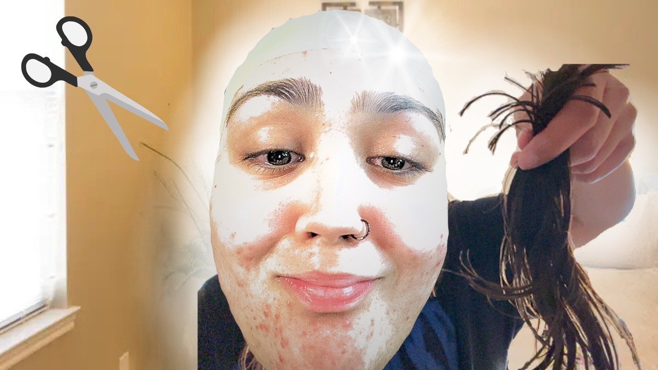 I WENT BALD BY ACCIDENT