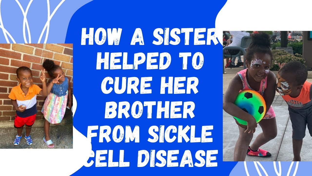 Bone marrow transplant to cure sickle cell disease. The current cure for sickle cell disease.