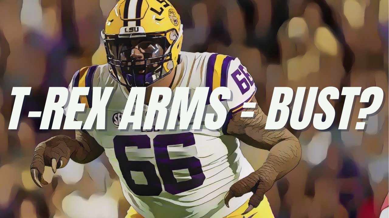 The NFL’s Weird Obsession With Arm Length