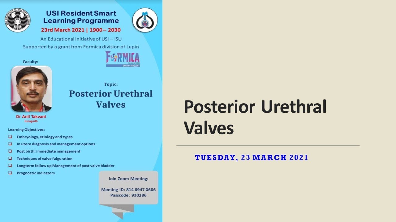 USI Smart Learning Program - 23rd March 2021 - Dr Anil Takvani on Posterior Urethral Valve