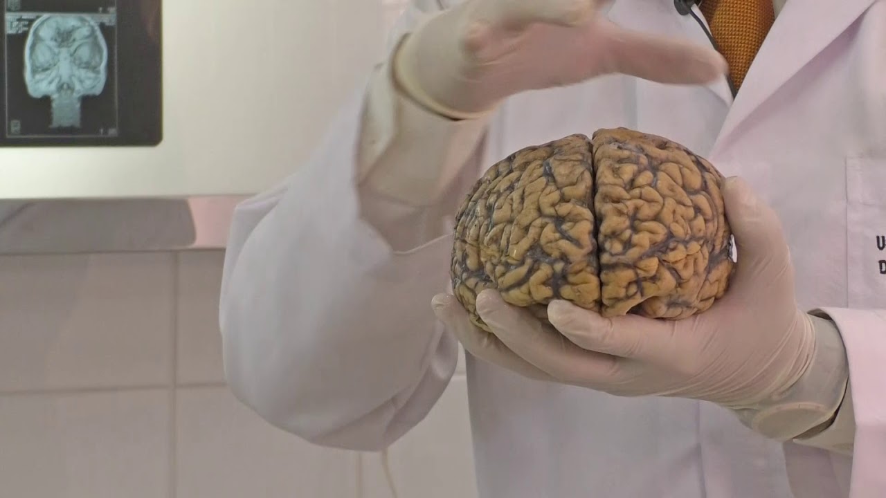 Neuroanatom&iacute;a