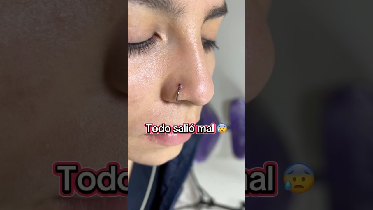 Granuloma en una perforaci&oacute;n de nariz ☹️
