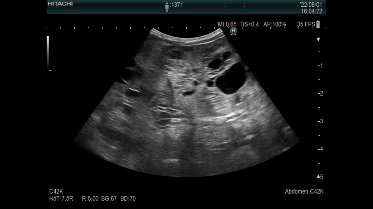 Liver ????　Pocket size vs Stationary high-end system、eho images、dog（7kg)