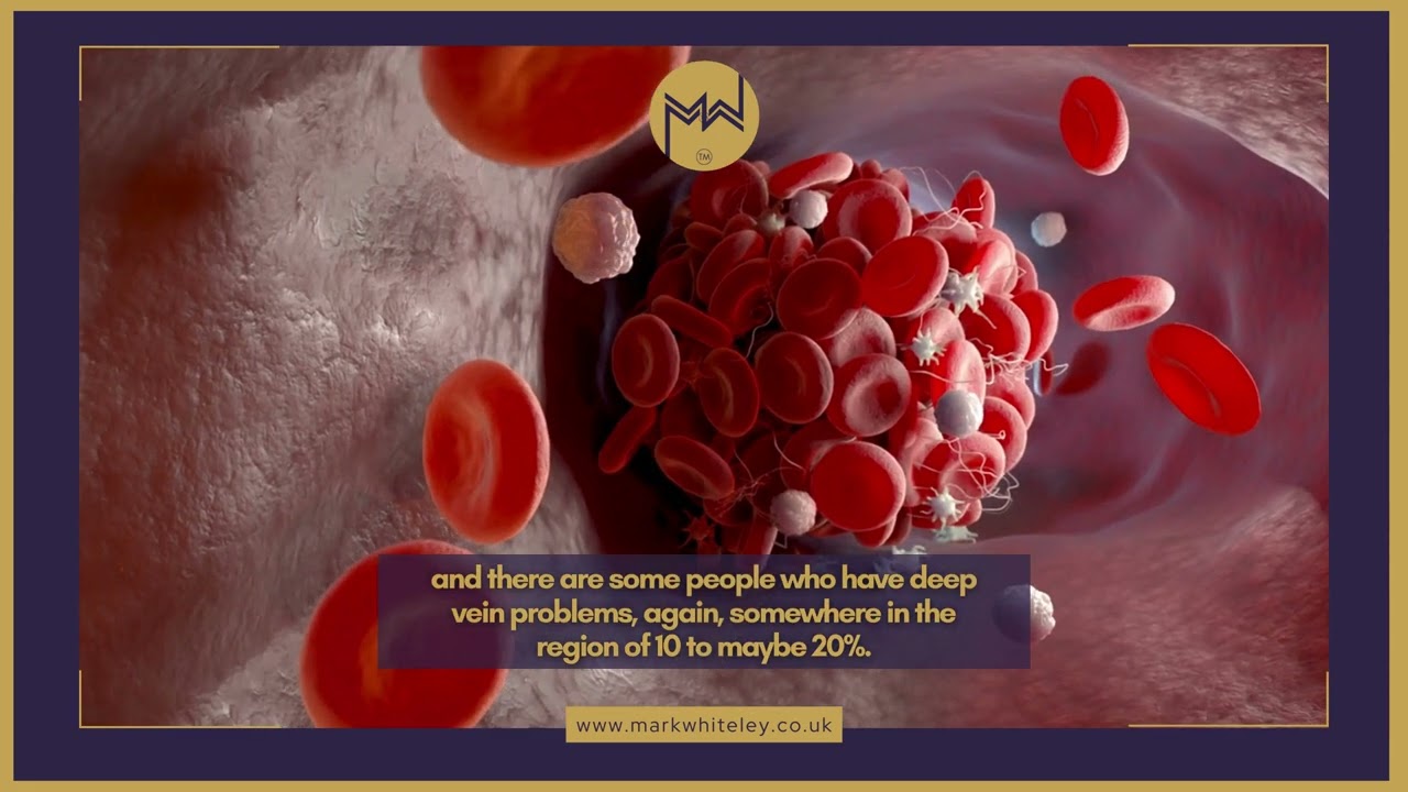 What Causes Leg Ulcers? By Prof. Mark Whiteley