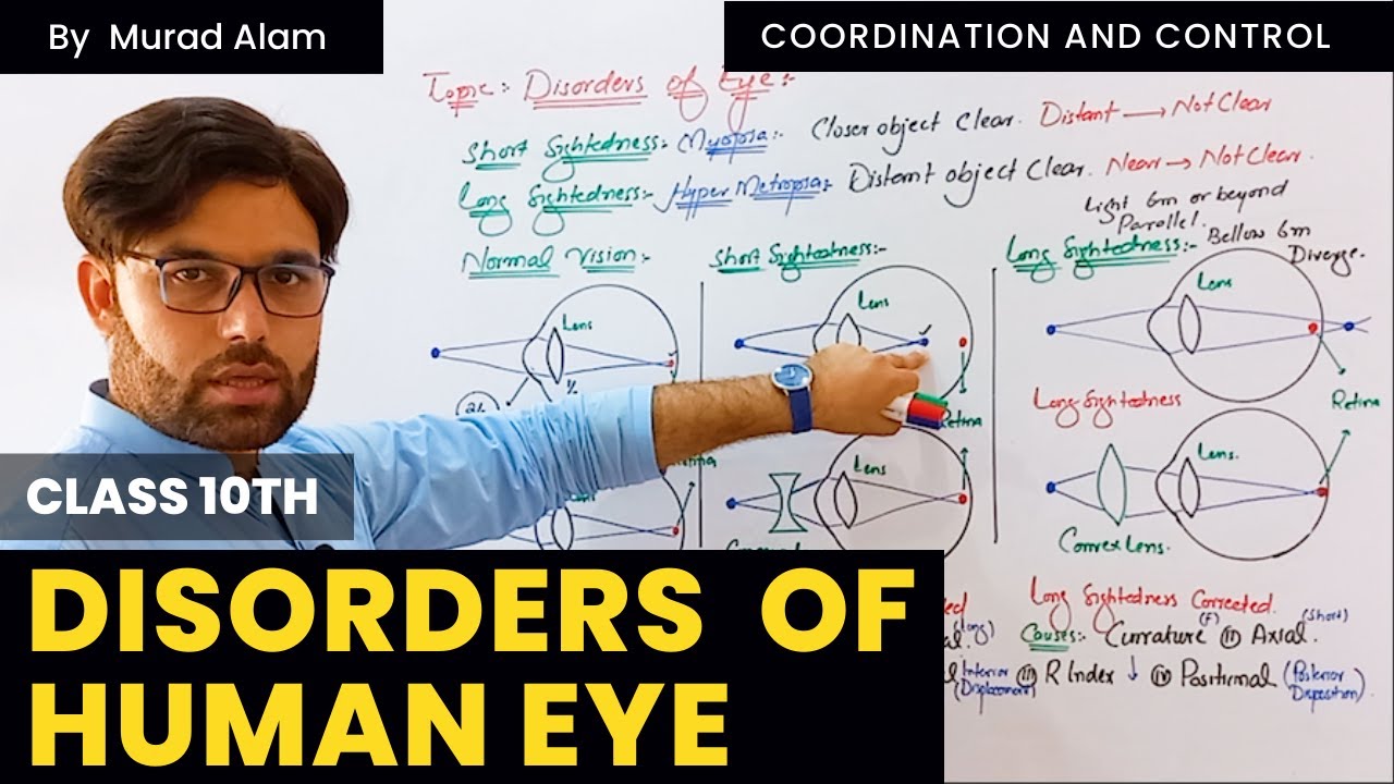 Disorders of Human Eye | Class 10th in Pashto | The Home of Science
