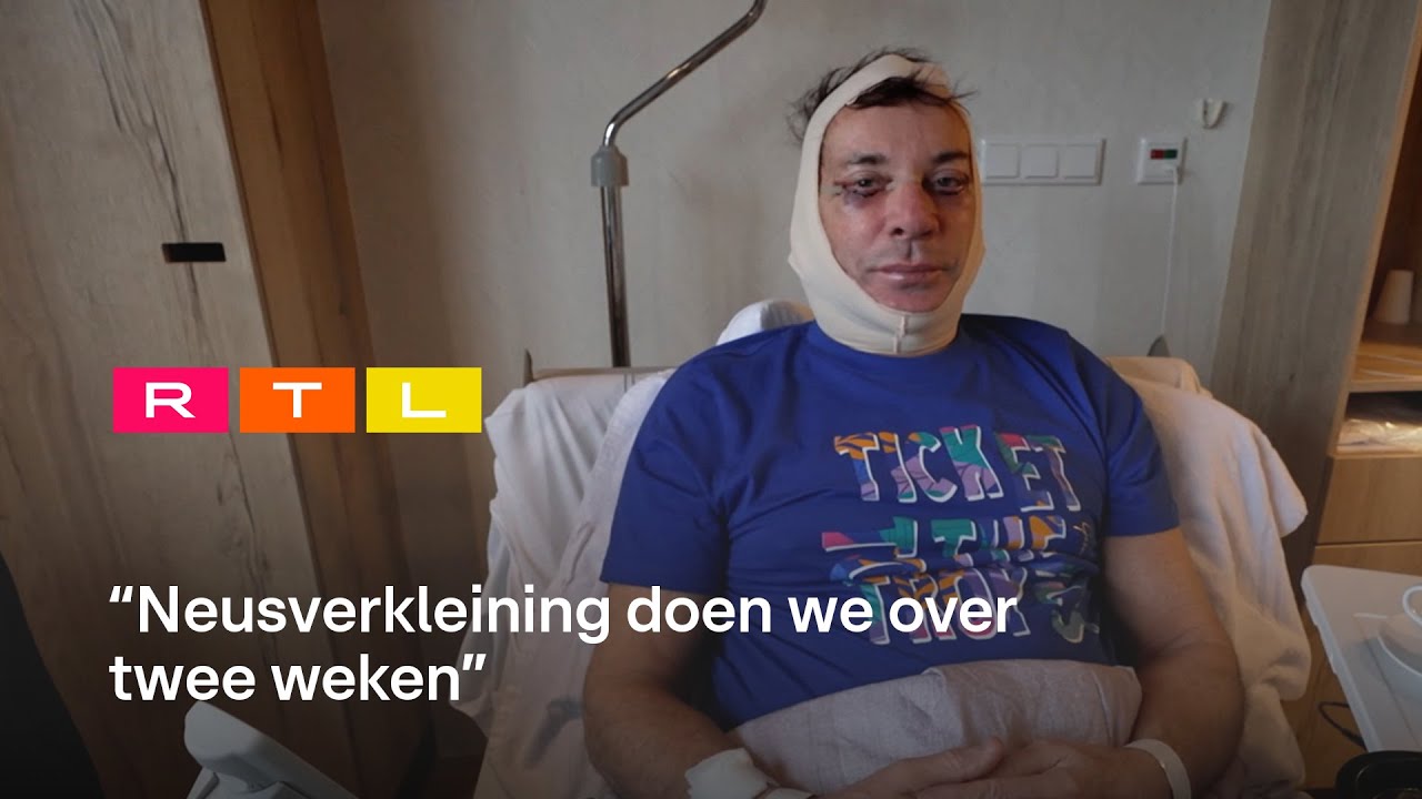 Gerard Joling onder het mes voor pittige ingreep: ‘Kan niet strak genoeg’ | Only Joling