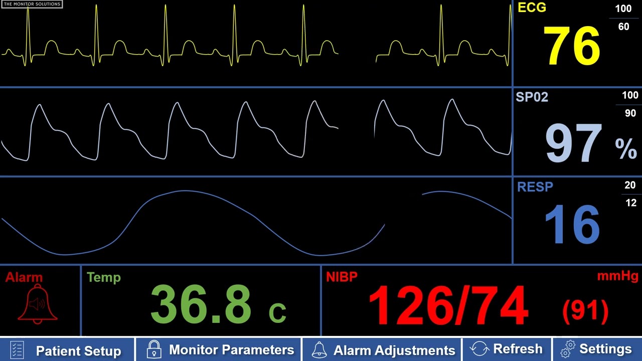 Simulated Adult Patient Monitor – NSR (Normal Sinus Rhythm)