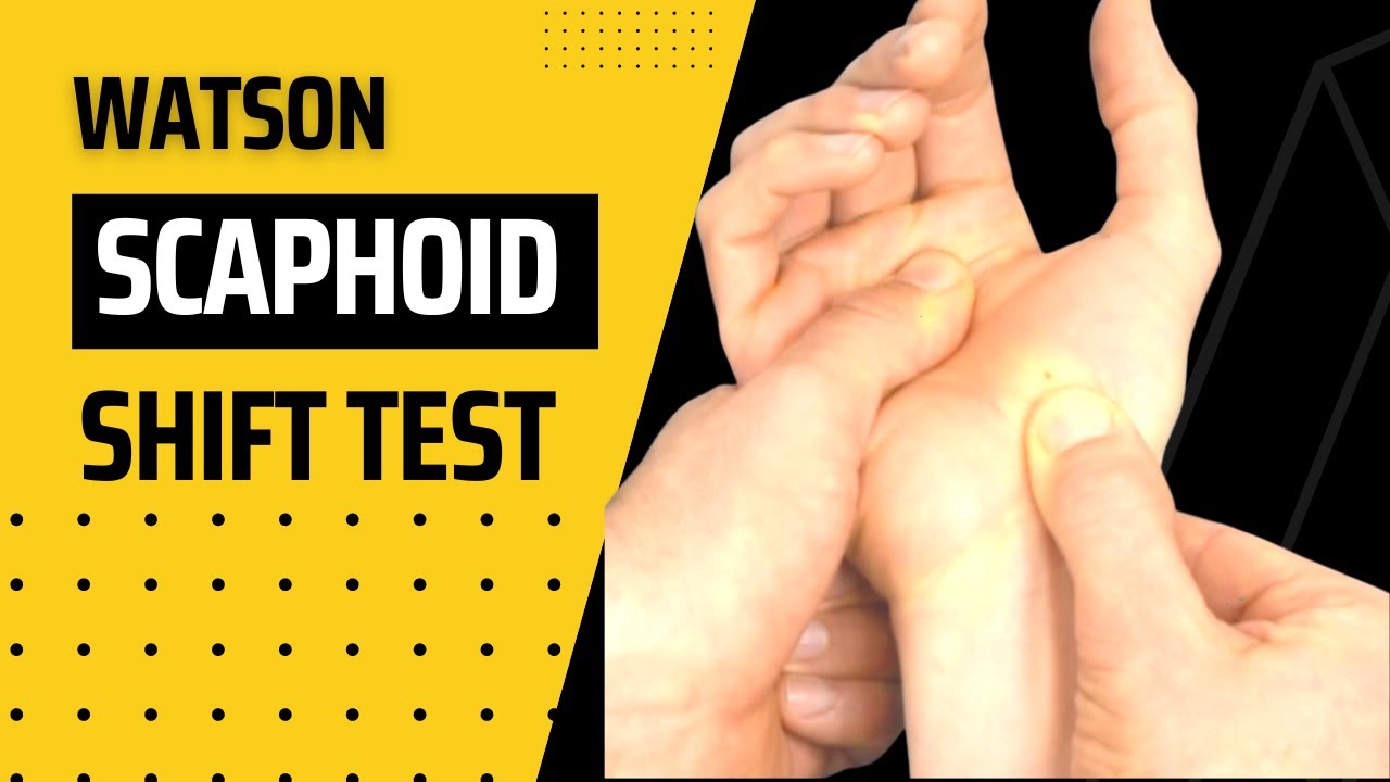 Watson Scaphoid Shift Test